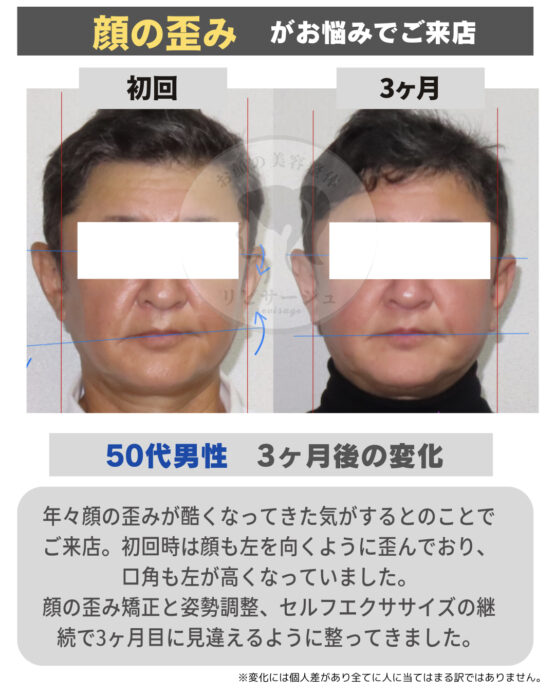 顔の美容リハビリ研究所　変化