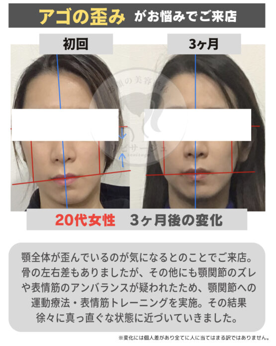 顔の美容リハビリ研究所　変化