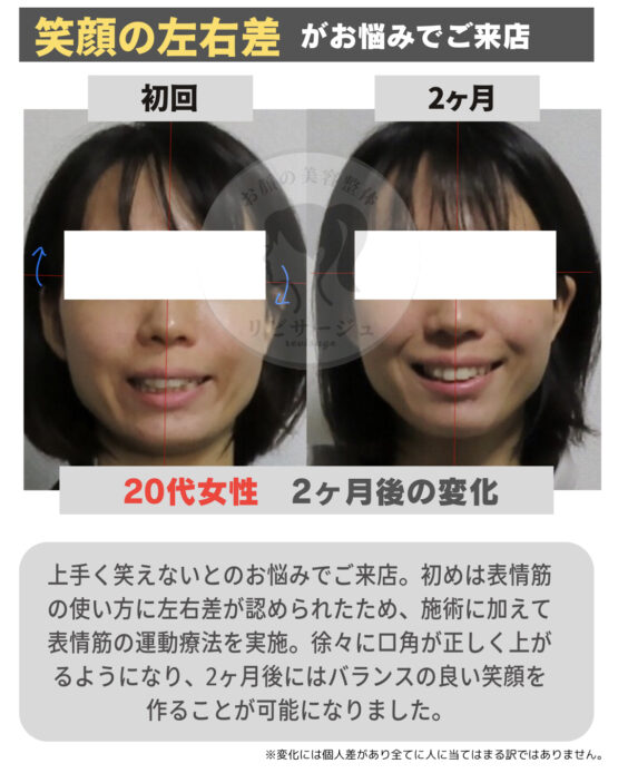 顔の美容リハビリ研究所　変化