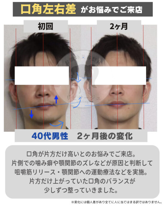 顔の美容リハビリ研究所　変化