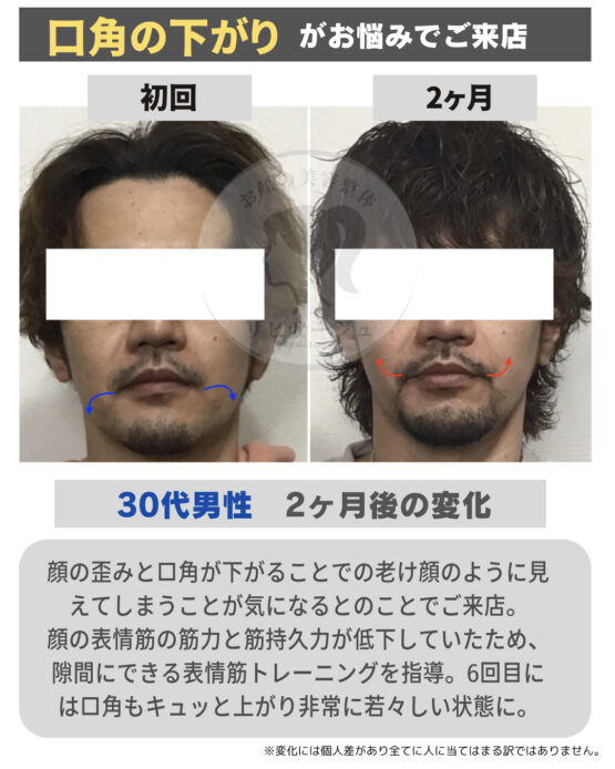 顔の美容リハビリ研究所　変化