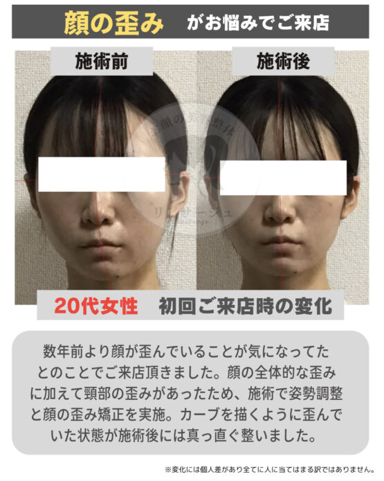 顔の美容リハビリ研究所　変化