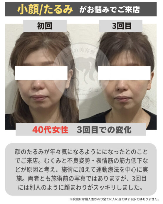 顔の美容リハビリ研究所　変化