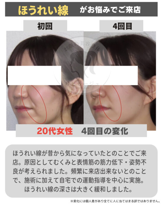 顔の美容リハビリ研究所　変化