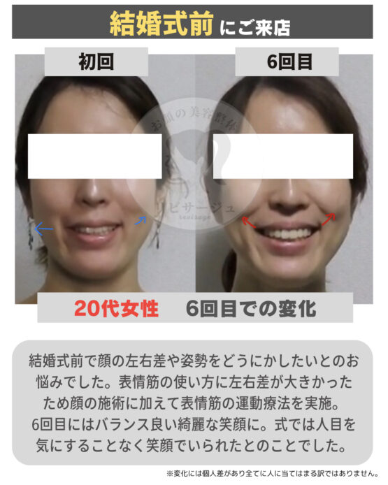 顔の美容リハビリ研究所　変化