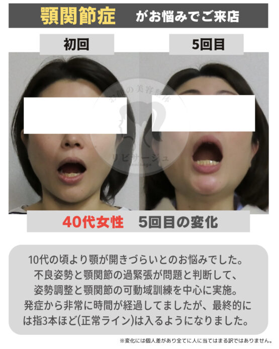 顔の美容リハビリ研究所　変化