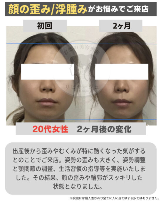 顔の美容リハビリ研究所　変化